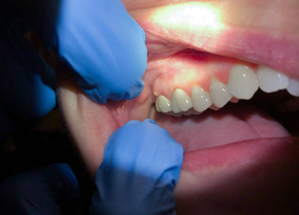Best Cosmetic Emergency Dentistry in Milton, GA