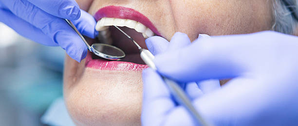 Best Emergency Gum Treatment in Milton, GA